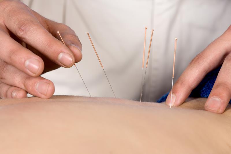 Acupuncture Scottsdale, AZ