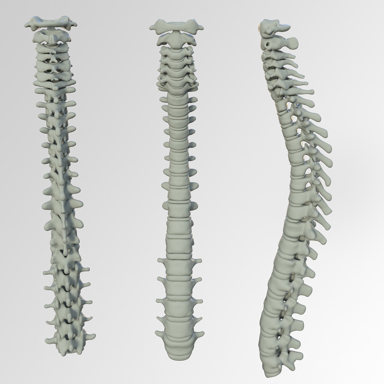 Spinal Screenings Scottsdale, AZ